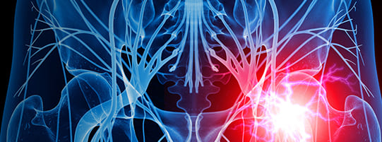 Chiropractic Therapy for Sciatic Pain post