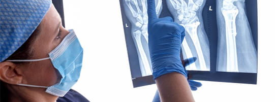 Common Wrist Injuries Caused by Car Accidents post