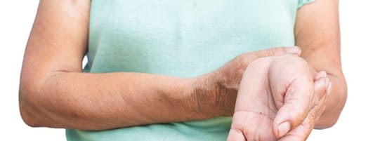 Experiencing Upper Limb Weakness After an Accident? Read This post