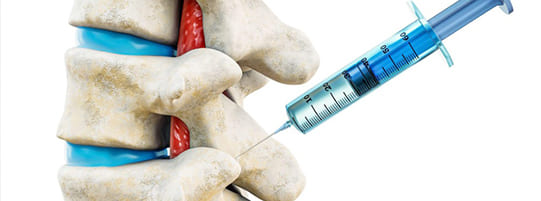 Facet Injections for Herniated Discs & Nerve Pain post