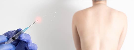 Facet Injections for Joint Injuries After an Auto Accident post