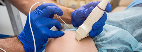 Reduce Car Accident Pain with Radiofrequency Ablation post