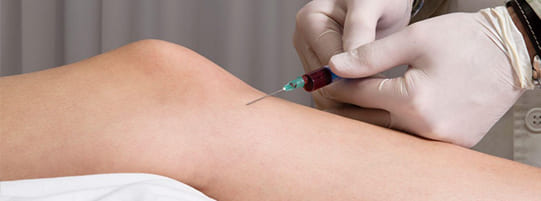 How to Treat Car Accident Pain Without Medicine post