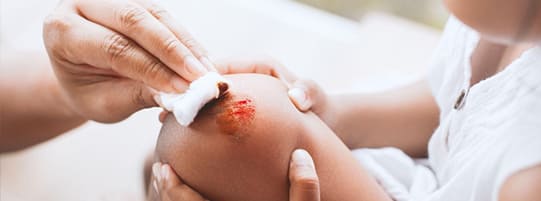 4 Reasons to Take Child Auto Accident Injuries Seriously post