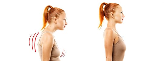 Did You Know Good Posture Can Support Post-Accident Healing? post