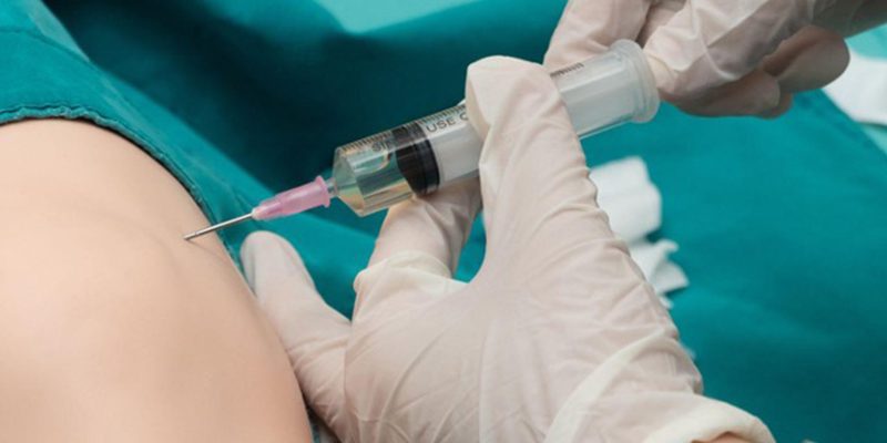 Are Facet Injections the Same as Epidural Injections? post