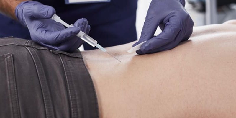 Top Non-Surgical Treatments for Accident Back Pain in 2024 post