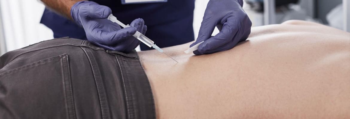 Top Non-Surgical Treatments for Accident Back Pain in 2024