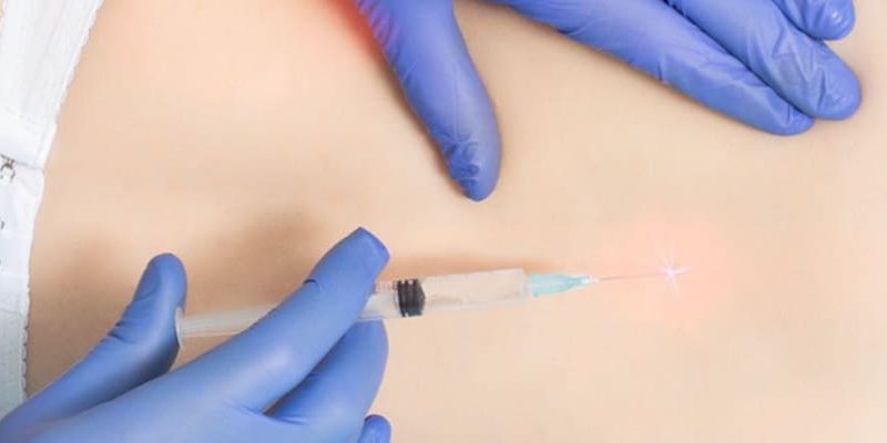 Impact Medical Group Lutz - Here’s How Joint Injections Can Help Treat Hip Bursitis Pain post