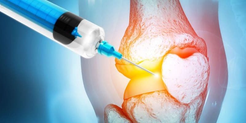 What Aftercare Is Needed After Facet Joint Injections? What To Do & What To Expect post