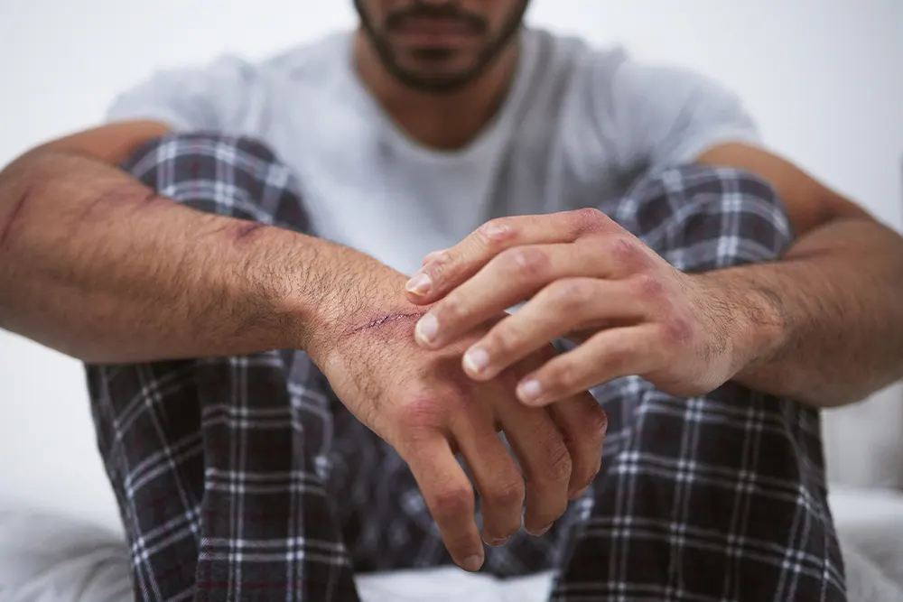 PTSD Mental health